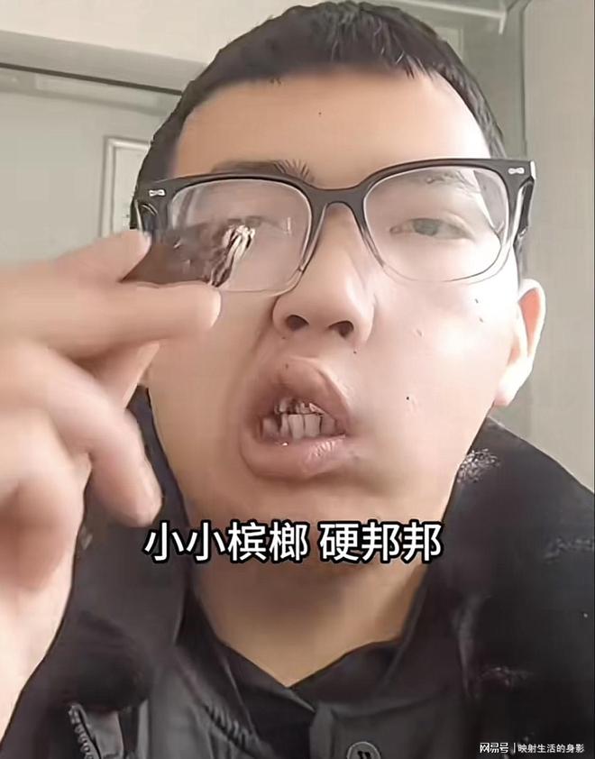 年导致脸部变形还边嚼边劝大家别碰槟榔尊龙凯时ag旗舰厅网站男子嚼槟榔七(图3)